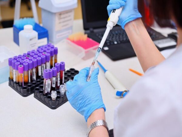 Blog 1 What Can I Expect from a Metabolic Panel Blood Test in Dearborn, MI?